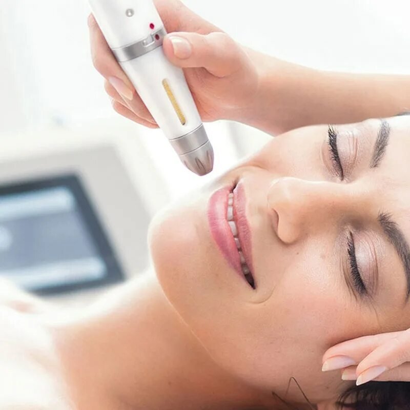 Tips for Preparing Your Skin for a Vampire Facelift